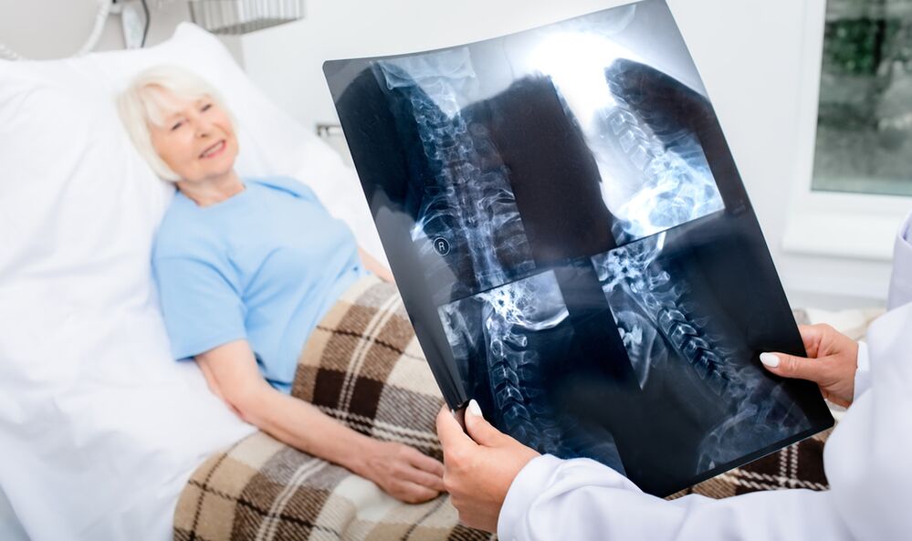 diagnoza osteohondroze