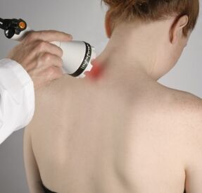 Laserska terapija bo pomagala lajšati vnetje in aktivirati regeneracijo tkiva v vratu