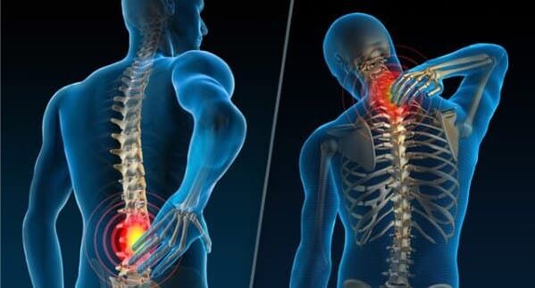 Znaki, ki kažejo na razvoj osteohondroze - bolečine v vratu in spodnjem delu hrbta