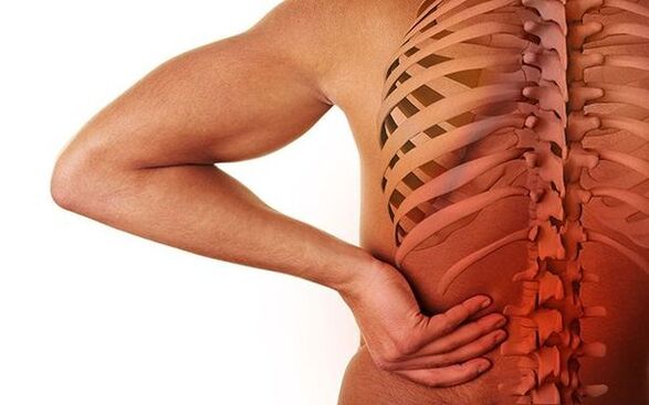 Bolečina je glavni nevrološki simptom hrbtenične osteohondroze