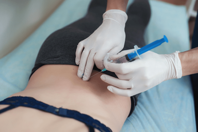 blokada ledvene osteohondroze