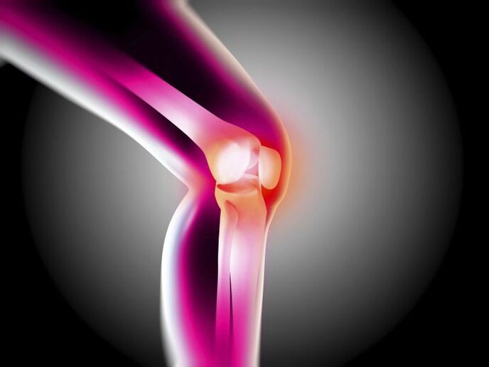 Arthroza